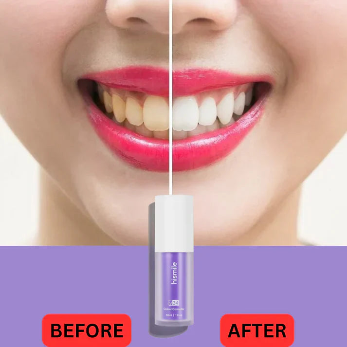 HiSmile v34 Advanced Teeth Whitening and Stains Removal Serum